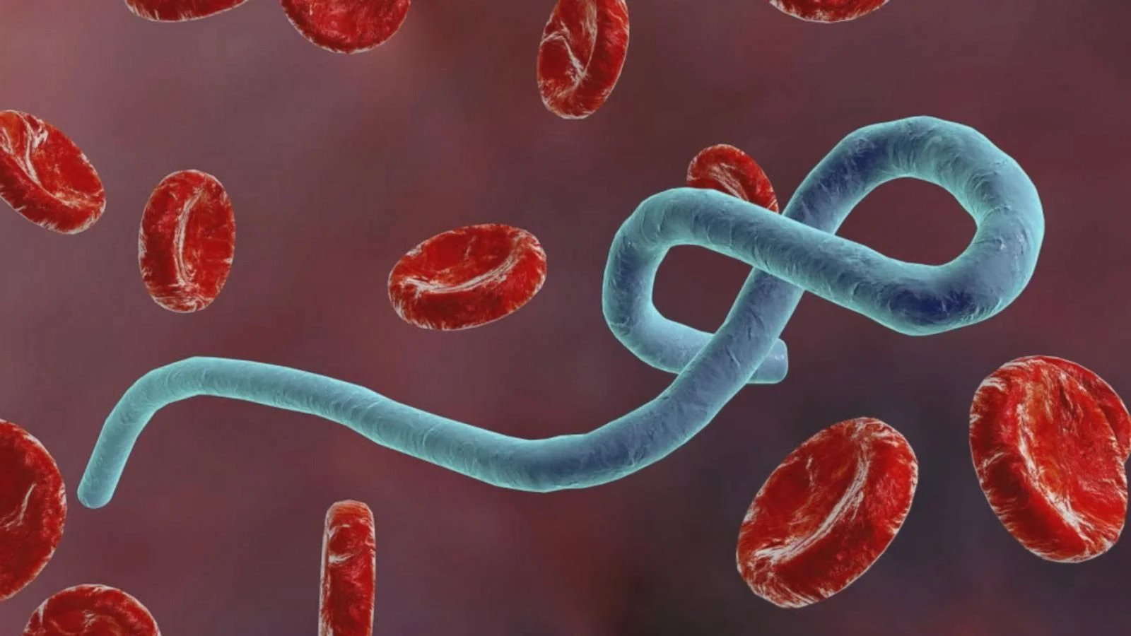 ebola virus