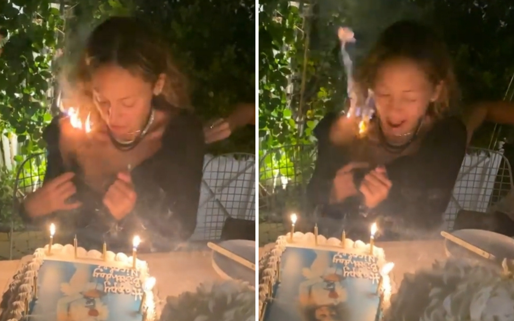 Nicole Richie’s hair caught fire while she was blowing out her birthday candles